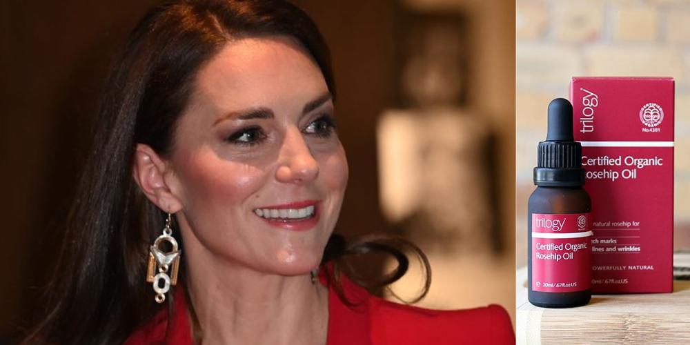 What’s The Secret Behind Kate Middleton’s Wrinkle free No Scar Radiant Skin?